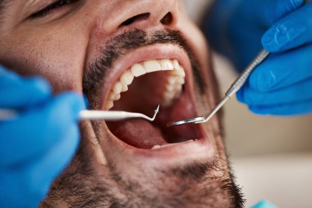 Best Dentist for Tooth Abscess  in Utica, NY